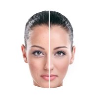 Supports Healthy, Clear-Looking Skin